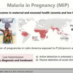 ASTMH 2018, Ana Maria Vasquez: “Performance of a P. falciparum ultrasensitive Rapid Diagnostic Test for malaria in pregnancy”