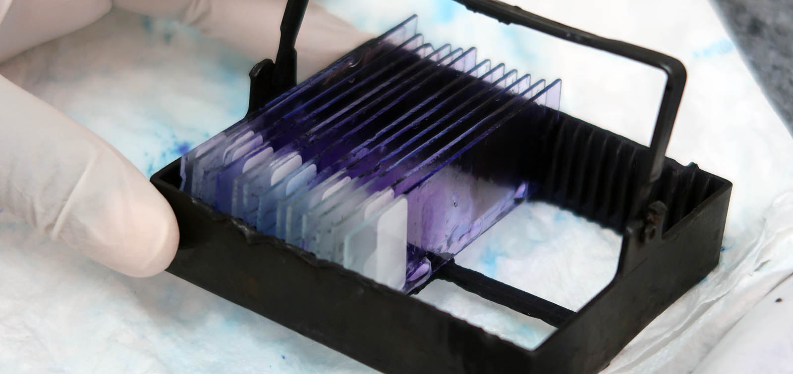 post matiana malaria 2