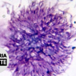 Malaria Minute Podcast: Serological Tests for P. vivax Malaria Could Reduce Disease Transmission by 69%