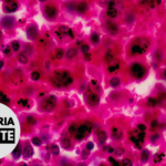 Malaria Minute Podcast: Spleen Plays Major Role in Plasmodium vivax Infection