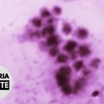 Malaria Minute Podcast: New Insights Into Erythrocyte-Binding Plasmodium Protein Revealed