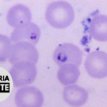 Malaria Minute Podcast: Host-Directed Interventions Could Reduce Malaria Burden