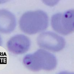 Malaria Minute Podcast: ‘Memory-Like’ Imprints in γδ T Cells Allow for Better Response to Future Malaria Infection