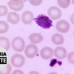 Malaria Minute Podcast: Parasite Biomarkers Predict Transmission Potential